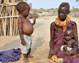 Африканские дети: почему у них такой большой живот?