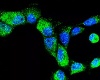 У русских была найдена сложная генетическая мутация