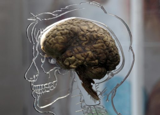 Японские ученые оживили мертвый мозг