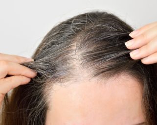 Дефицит железа — причина ранней седины