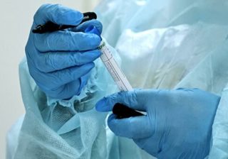 В Германии ученые сообщили о прорыве в борьбе с коронавирусом