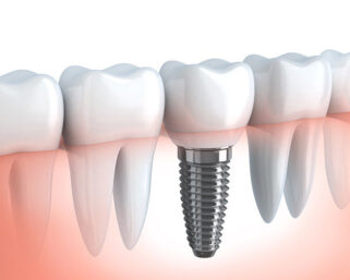 Простой тест по русскому языку