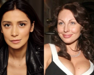 Звездная пластика: кто из российских селебритис «обновил» себя, а кто любит природную красоту