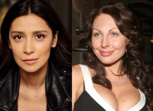 Звездная пластика: кто из российских селебритис «обновил» себя, а кто любит природную красоту